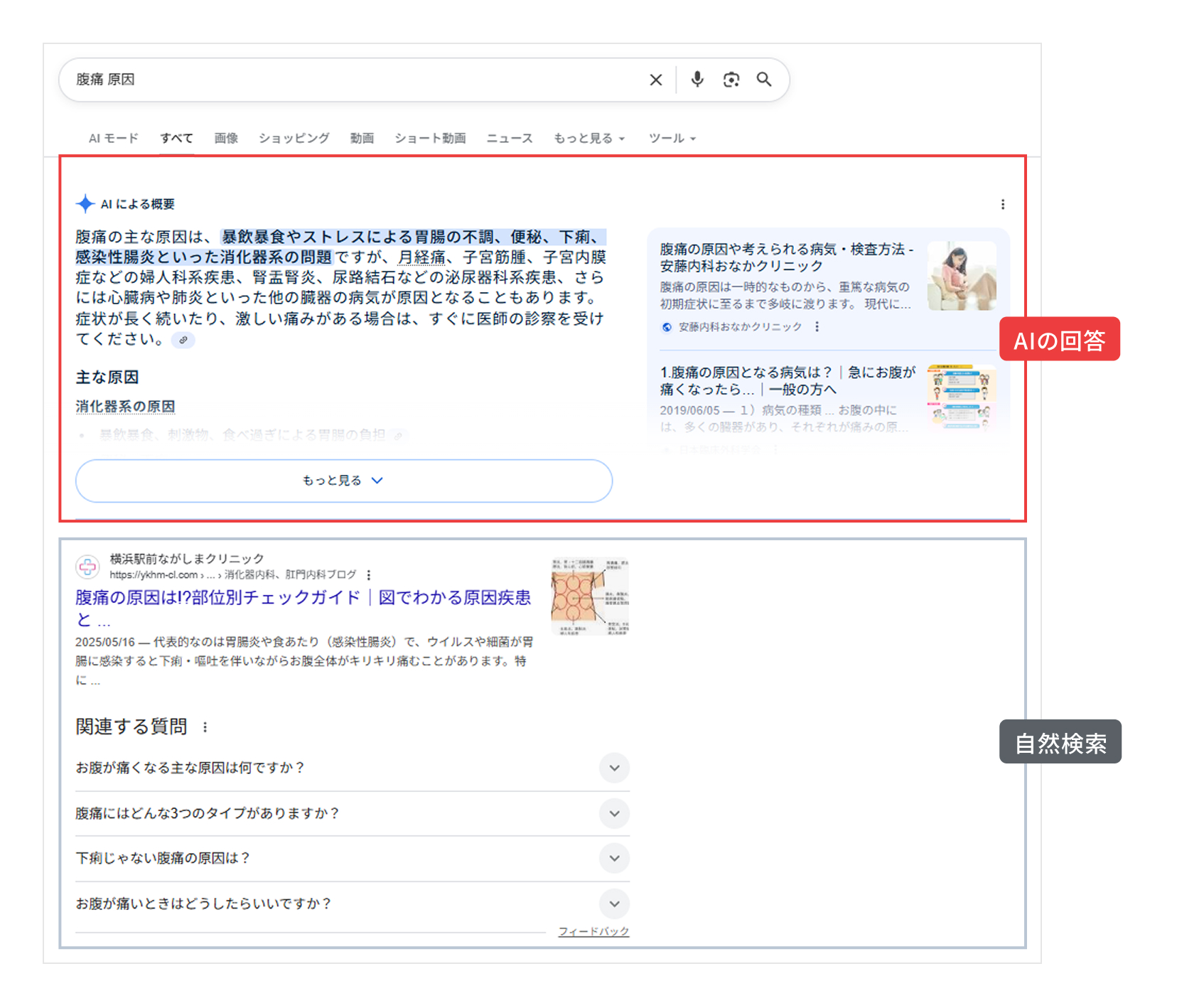 検索画面の上部にAIの回答が表示されるようになっているから