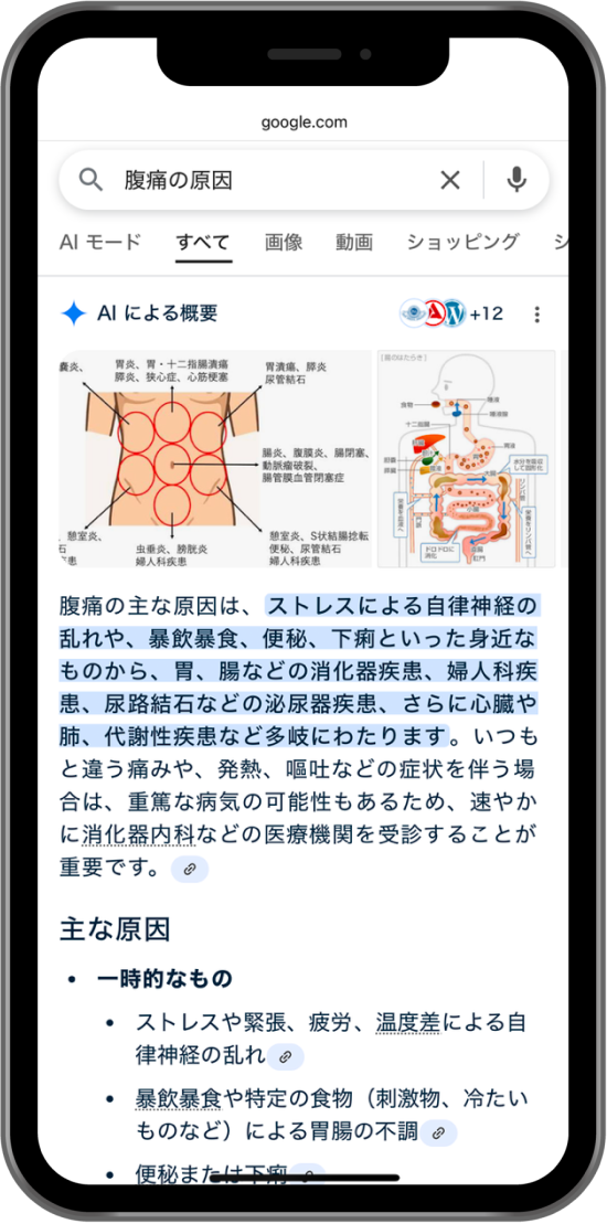 Google AIによる概要
