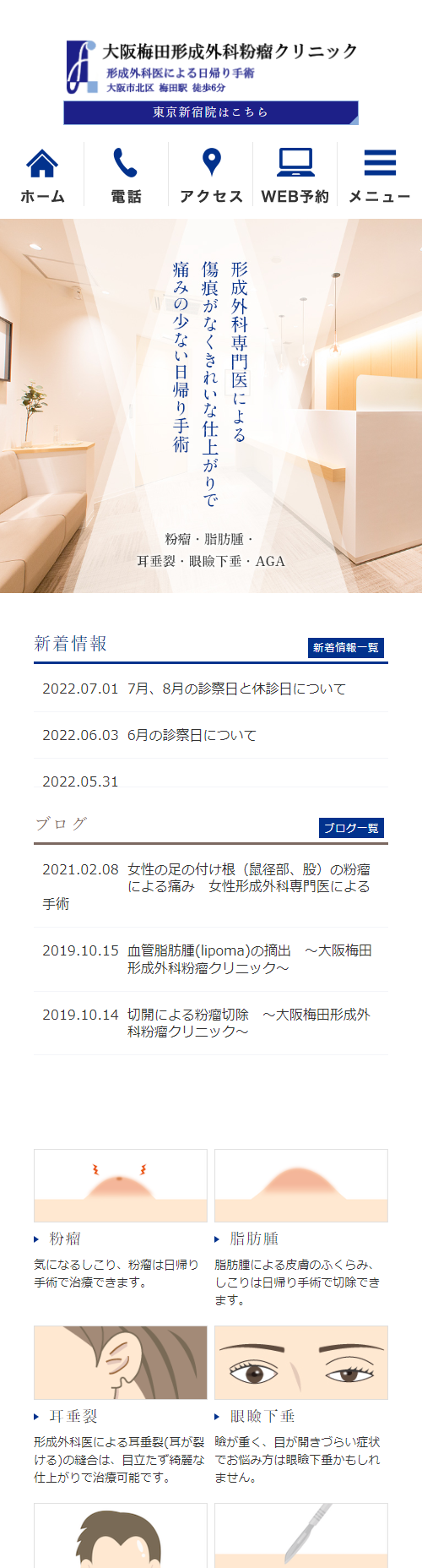 大阪梅田形成外科粉瘤クリニックスマホサイトイメージ